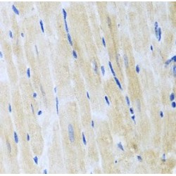 Inositol-Trisphosphate 3-Kinase B (ITPKB) Antibody