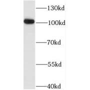 WB analysis of human heart tissue, using ITPKC antibody (1/400 dilution).