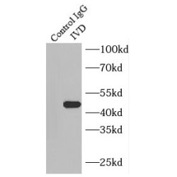 Isovaleryl-CoA Dehydrogenase, Mitochondrial (IVD) Antibody