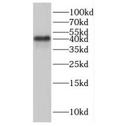 WB analysis of MCF7 cells, using IVD antibody (1/300 dilution).