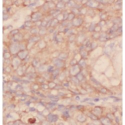 Isovaleryl-CoA Dehydrogenase, Mitochondrial (IVD) Antibody