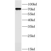 WB analysis of mouse spleen tissue, using JAKMIP1 antibody (1/800 dilution).