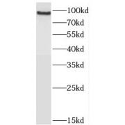 WB analysis of mouse brain tissue, using JAKMIP2 antibody (1/1000 dilution).