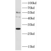 WB analysis of HL-60 cells, using AMICA1 antibody (1/800 dilution).