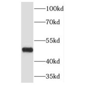 WB analysis of HeLa cells, using JMJD4 antibody (1/600 dilution).