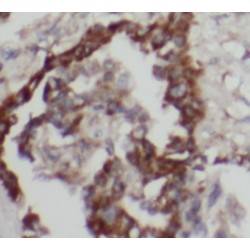 JNK Antibody