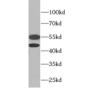 WB analysis of HEK-293 cells, using JNK antibody (1/1000 dilution).