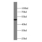 WB analysis of HEK-293 cells, using JNK antibody (1/3000 dilution).