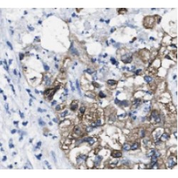 JP45 / JSRP1 Antibody