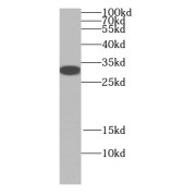 WB analysis of human skeletal muscle tissue, using JP45; JSRP1 antibody (1/600 dilution).