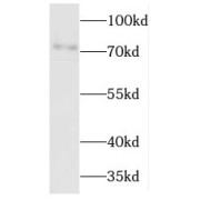 WB analysis of HEK-293 cells, using JPH1 antibody (1/2000 dilution).