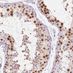 Aminoacyl tRNA Synthase Complex-Interacting Multifunctional Protein 2 (JTV1) Antibody