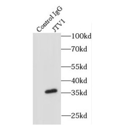 Aminoacyl tRNA Synthase Complex-Interacting Multifunctional Protein 2 (JTV1) Antibody