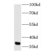 WB analysis of HeLa cells, using JTV1 antibody (1/1000 dilution).