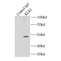 Kallikrein 1 (KLK1) Antibody