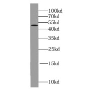 WB analysis of A375 cells, using KLK1 antibody (1/500 dilution).