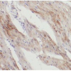 KN Motif And Ankyrin Repeat Domain Containing Protein 1 (KANK1) Antibody