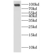 WB analysis of mouse lung tissue, using KANK2 antibody (1/800 dilution).