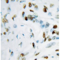 Transcription Intermediary Factor 1-Beta (TRIM28) Antibody