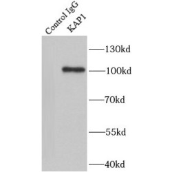 Transcription Intermediary Factor 1-Beta (TRIM28) Antibody