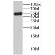 WB analysis of HeLa cells, using KATNAL1 antibody (1/300 dilution).