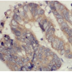 kazrin Antibody