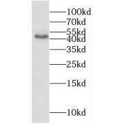 WB analysis of human heart tissue, using kazrin antibody (1/1200 dilution).