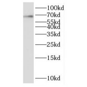 WB analysis of mouse brain tissue, using KCNA5 antibody (1/600 dilution).