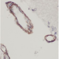 Voltage-Gated Potassium Channel Subunit Beta-1 (KCNAB1) Antibody