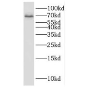 WB analysis of mouse heart tissue, using KCNAB1 antibody (1/1500 dilution).