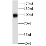 WB analysis of mouse brain membrane tissue, using KCNC4 antibody (1/300 dilution).