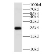 WB analysis of human cerebellum tissue, using KCNIP1 antibody (1/500 dilution).