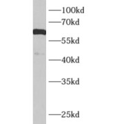 WB analysis of mouse brain, using KCNJ3 antibody (1/1000 dilution).