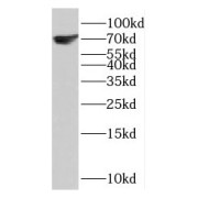 WB analysis of mouse brain tissue, using KCNN1 antibody (1/4000 dilution).