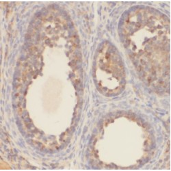 Potassium Channel Tetramerization Domain Containing 5 (KCTD5) Antibody