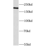 WB analysis of HeLa cells, using KDM3B antibody (1/500 dilution).