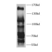 WB analysis of mouse brain tissue, using KDM4A antibody (1/1000 dilution).