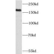 WB analysis of HeLa cells, using KDM5C antibody (1/500 dilution).