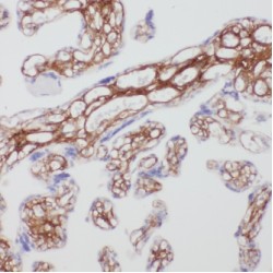 3-Ketodihydrosphingosine Reductase (KDSR) Antibody