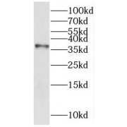 WB analysis of L02 cells, using KHDC1 antibody (1/600 dilution).