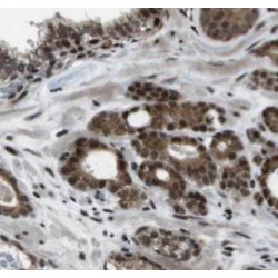 KH-Type Splicing Regulatory Protein (KHSRP) Antibody