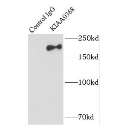 KIAA0368 Antibody