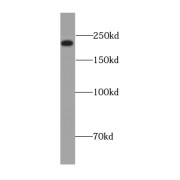 WB analysis of HEK-293 cells, using KIAA0368 antibody (1/600 dilution).