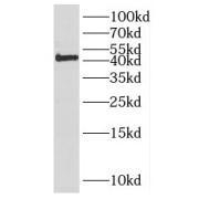 WB analysis of COLO 320 cells, using KIAA0494 antibody (1/600 dilution).