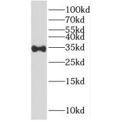 WB analysis of mouse ovary tissue, using KIAA1191 antibody (1/200 dilution).