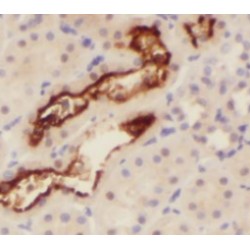 KIAA1602 Antibody