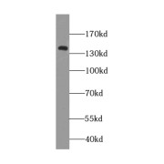 WB analysis of HeLa cells, using KIAA1602 antibody (1/300 dilution).