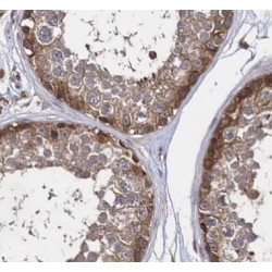 Kinesin Family Member 15 (KIF15) Antibody