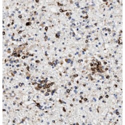 Kinesin Family Member 17 (KIF17) Antibody