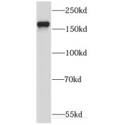 WB analysis of mouse brain tissue, using KIF17 antibody (1/1000 dilution).